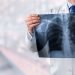 Community Acquired Pneumonia Treatment
