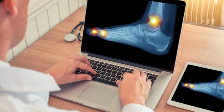 gout patients