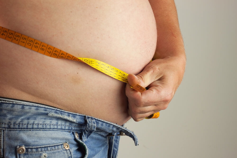 obesity