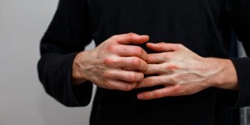 Pustular Psoriasis