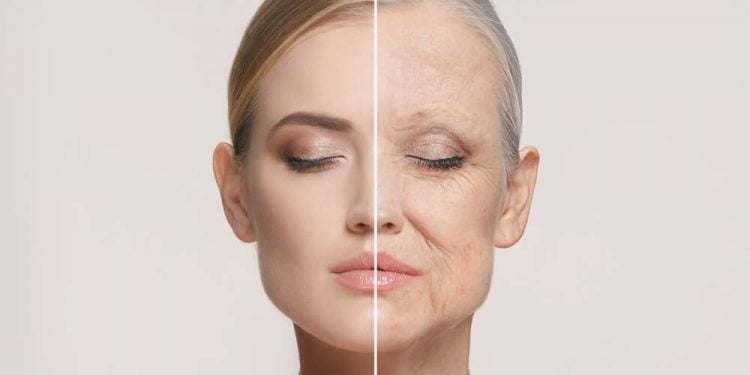 Different types of wrinkle