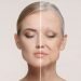 Different types of wrinkle