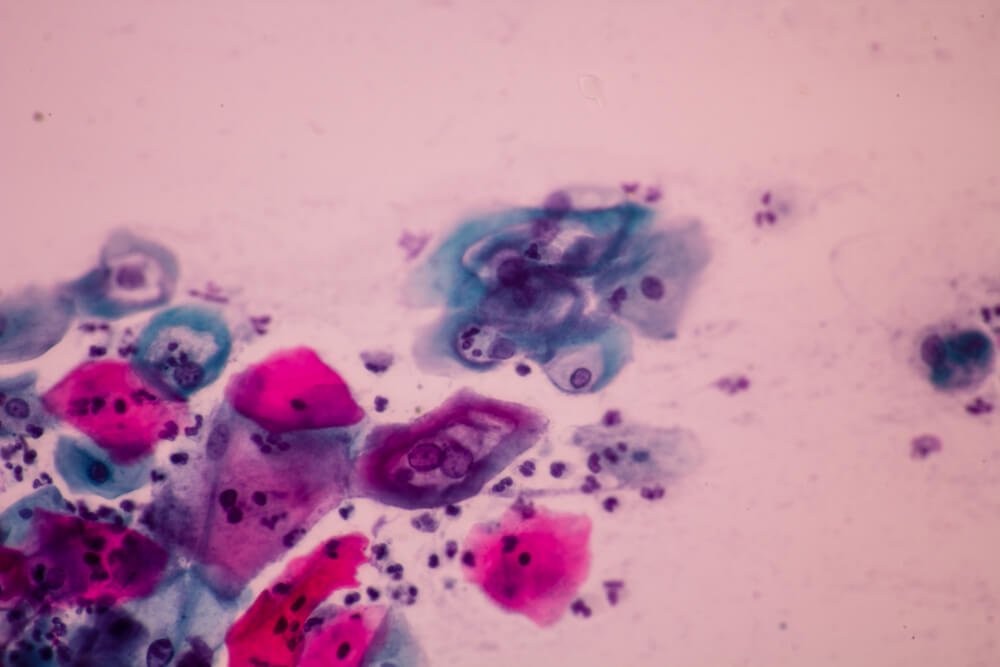 HPV Virus