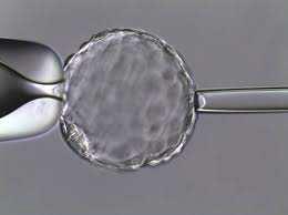 blastocyst biopsy IVI 