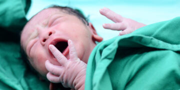 IVI reduces the percentage of babies born with low birth weight