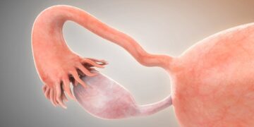 IVI study for women with premature ovarian failure
