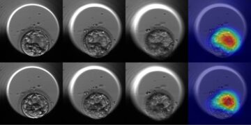 Improvements in embryo selection thanks to Artificial Intelligence