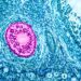 FSH hormone: how does it affect my fertility?