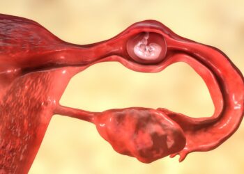 Ectopic pregnancy and fertility – IVI